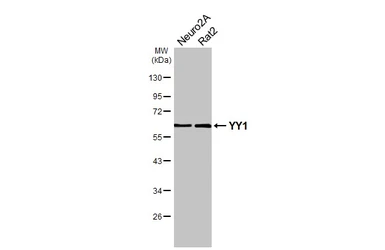 Anti-YY1 antibody [HL4198] used in Western Blot (WB). GTX643021