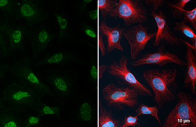 Anti-YY1 antibody [HL4198] used in Immunocytochemistry/ Immunofluorescence (ICC/IF). GTX643021