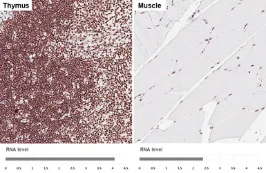 Anti-YY1 antibody [HL4198] used in IHC (Paraffin sections) (IHC-P). GTX643021