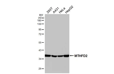Anti-MTHFD2 antibody [HL4200] used in Western Blot (WB). GTX643023