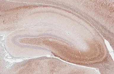 Anti-BDNF antibody [HL4205] used in IHC (Paraffin sections) (IHC-P). GTX643028