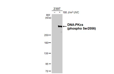 Anti-DNA-PKcs (phospho Ser2056) antibody [HL4206] used in Western Blot (WB). GTX643029
