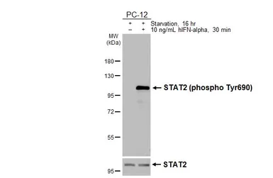 Anti-STAT2 (phospho Tyr690) antibody [HL4208] used in Western Blot (WB). GTX643031
