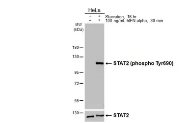Anti-STAT2 (phospho Tyr690) antibody [HL4208] used in Western Blot (WB). GTX643031