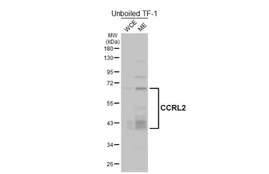Anti-CCRL2 antibody [HL4222] used in Western Blot (WB). GTX643044