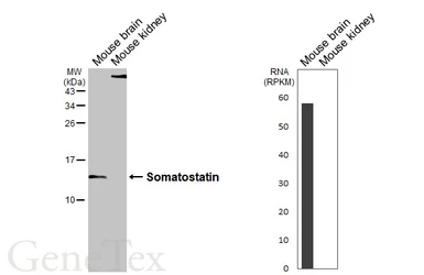 Anti-Somatostatin antibody [GT183] used in Western Blot (WB). GTX643046