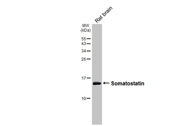 Anti-Somatostatin antibody [GT183] used in Western Blot (WB). GTX643046