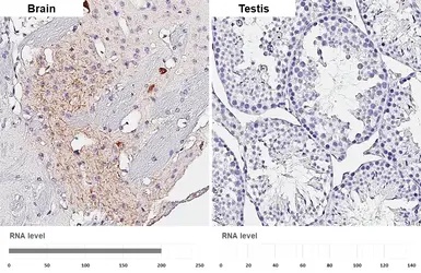 Anti-Somatostatin antibody [GT183] used in IHC (Paraffin sections) (IHC-P). GTX643046