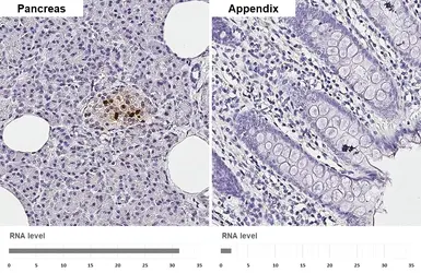 Anti-Somatostatin antibody [GT183] used in IHC (Paraffin sections) (IHC-P). GTX643046