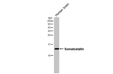 Anti-Somatostatin antibody [GT183] used in Western Blot (WB). GTX643046