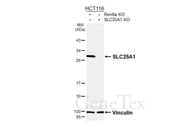 Anti-SLC25A1 antibody [HL4227] used in Western Blot (WB). GTX643060