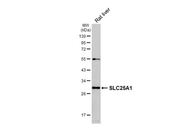 Anti-SLC25A1 antibody [HL4227] used in Western Blot (WB). GTX643060
