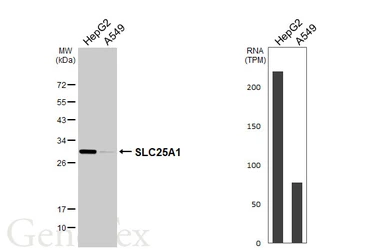 Anti-SLC25A1 antibody [HL4227] used in Western Blot (WB). GTX643060
