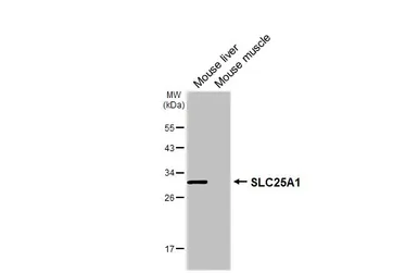Anti-SLC25A1 antibody [HL4227] used in Western Blot (WB). GTX643060
