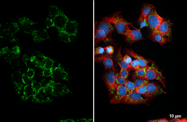 Anti-SLC25A1 antibody [HL4228] used in Immunocytochemistry/ Immunofluorescence (ICC/IF). GTX643061