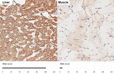 Anti-SLC25A1 antibody [HL4228] used in IHC (Paraffin sections) (IHC-P). GTX643061