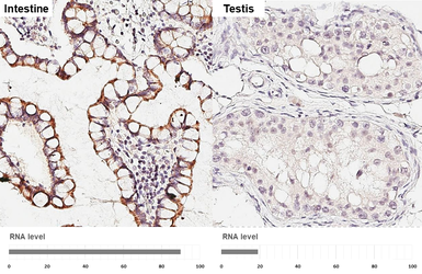 Anti-SLC25A1 antibody [HL4228] used in IHC (Paraffin sections) (IHC-P). GTX643061