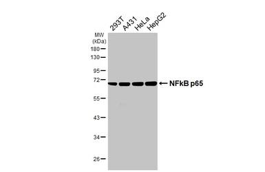 Anti-NFkB p65 antibody [HL4229] used in Western Blot (WB). GTX643062