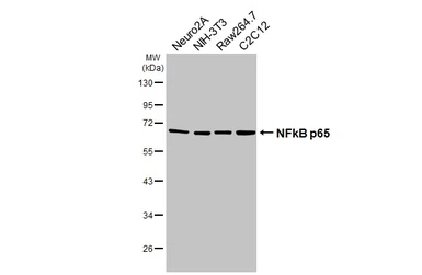 Anti-NFkB p65 antibody [HL4229] used in Western Blot (WB). GTX643062