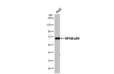 Anti-NFkB p65 antibody [HL4229] used in Western Blot (WB). GTX643062