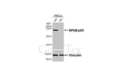 Anti-NFkB p65 antibody [HL4229] used in Western Blot (WB). GTX643062