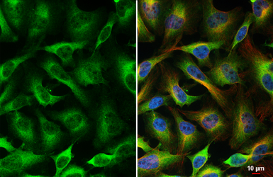 Anti-NFkB p65 antibody [HL4229] used in Immunocytochemistry/ Immunofluorescence (ICC/IF). GTX643062