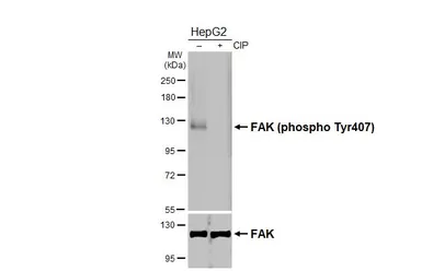 Anti-FAK (phospho Tyr407) antibody [HL4231] used in Western Blot (WB). GTX643064