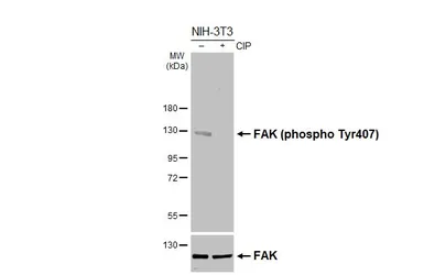 Anti-FAK (phospho Tyr407) antibody [HL4231] used in Western Blot (WB). GTX643064