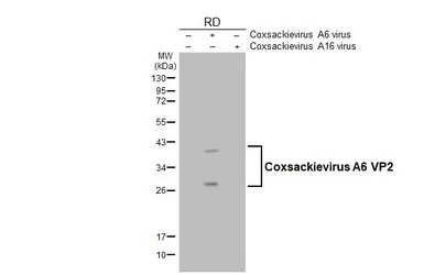Anti-Coxsackievirus A6 VP2 antibody [HL4233] used in Western Blot (WB). GTX643066