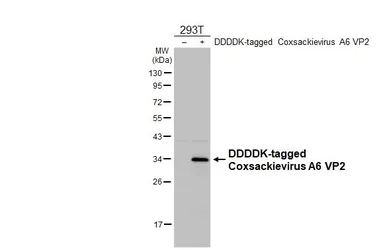 Anti-Coxsackievirus A6 VP2 antibody [HL4233] used in Western Blot (WB). GTX643066