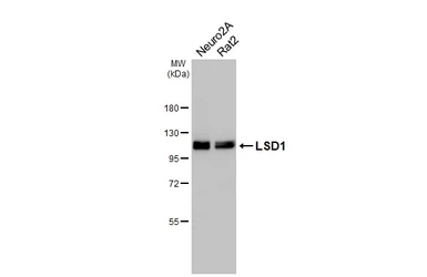 Anti-LSD1 antibody [HL4238] used in Western Blot (WB). GTX643071