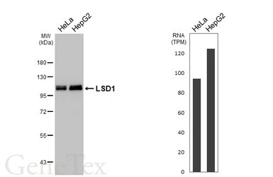 Anti-LSD1 antibody [HL4238] used in Western Blot (WB). GTX643071