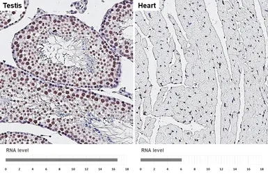 Anti-LSD1 antibody [HL4238] used in IHC (Paraffin sections) (IHC-P). GTX643071