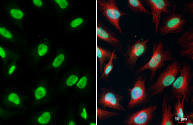 Anti-LSD1 antibody [HL4238] used in Immunocytochemistry/ Immunofluorescence (ICC/IF). GTX643071