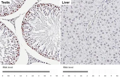 Anti-LSD1 antibody [HL4238] used in IHC (Paraffin sections) (IHC-P). GTX643071
