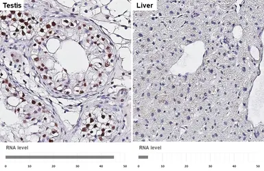 Anti-LSD1 antibody [HL4238] used in IHC (Paraffin sections) (IHC-P). GTX643071