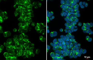 Anti-FPRL1 antibody [HL4245] used in Immunocytochemistry/ Immunofluorescence (ICC/IF). GTX643078