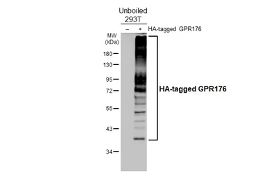 Anti-GPR176 antibody [HL4247] used in Western Blot (WB). GTX643080