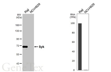 Anti-Syk antibody [HL4248] used in Western Blot (WB). GTX643081
