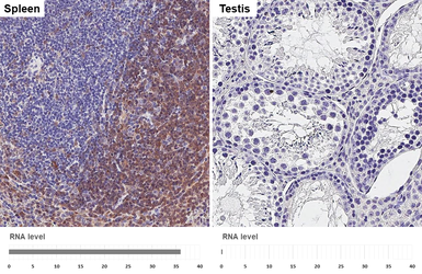Anti-Syk antibody [HL4248] used in IHC (Paraffin sections) (IHC-P). GTX643081