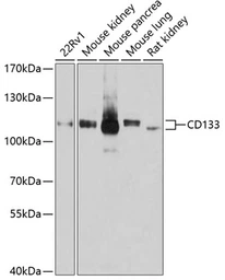 Anti-CD133 antibody used in Western Blot (WB). GTX64328