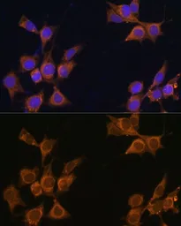 Anti-CD133 antibody used in Immunocytochemistry/ Immunofluorescence (ICC/IF). GTX64328