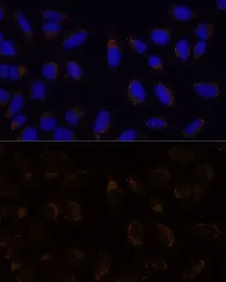 Anti-CD133 antibody used in Immunocytochemistry/ Immunofluorescence (ICC/IF). GTX64328