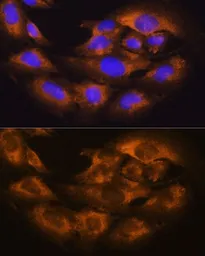 Anti-CD13 antibody used in Immunocytochemistry/ Immunofluorescence (ICC/IF). GTX64331