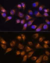 Anti-CD13 antibody used in Immunocytochemistry/ Immunofluorescence (ICC/IF). GTX64331