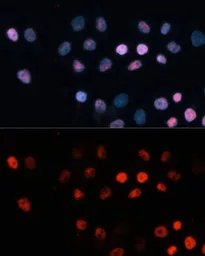 Anti-TET1 antibody used in Immunocytochemistry/ Immunofluorescence (ICC/IF). GTX64332