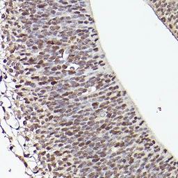 Anti-TET1 antibody used in IHC (Paraffin sections) (IHC-P). GTX64332