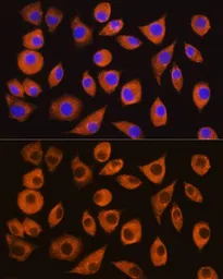 Anti-CD26 antibody used in Immunocytochemistry/ Immunofluorescence (ICC/IF). GTX64333