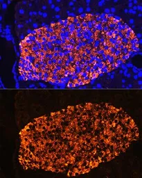 Anti-Insulin antibody used in IHC (Paraffin sections) (IHC-P). GTX64334