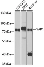 Anti-YAP1 antibody used in Western Blot (WB). GTX64336
